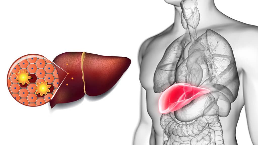 Researchers Explain Why Detoxing Your Liver is So Important for Your Health