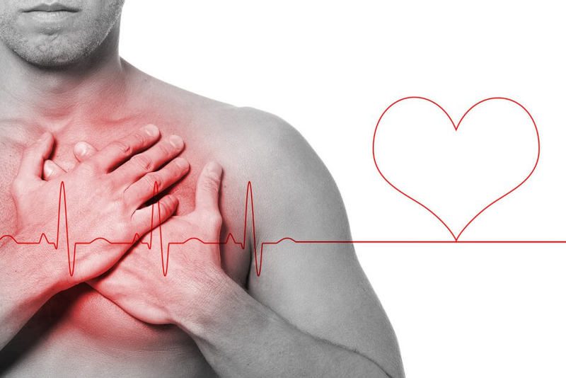 ATAQUE CARDÍACO SILENCIOSO: Infarto de miocardio asintomático